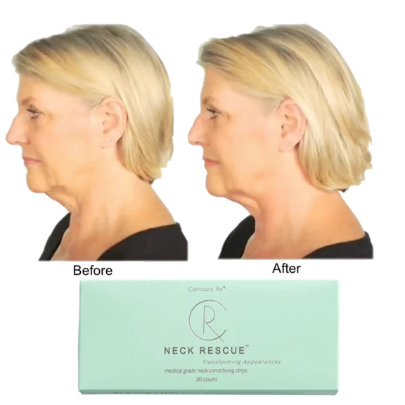 60-Pack Contours Rx NECK RESCUE Non-Surgical Correcting Strips