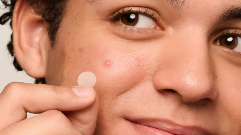 216-Pack: Mighty Patch Acne and Pimple Patches