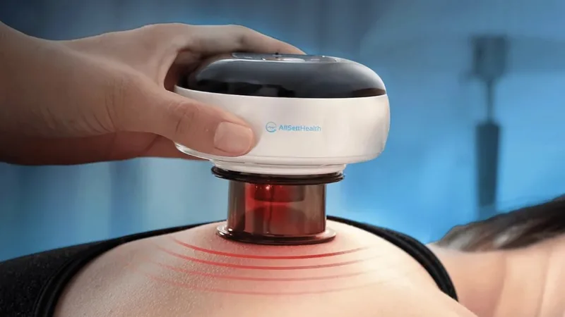 2-Pack: The Pulse Cup 5-in-1 Cupping Massage Set