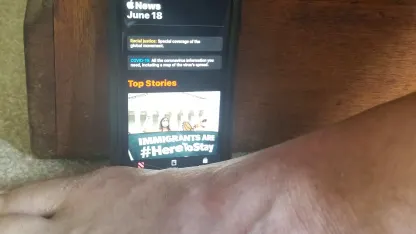 Ugly foot