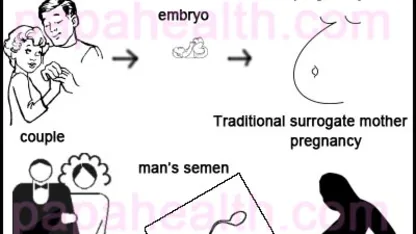 What is suitable surrogate mother?