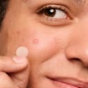 SideDeal Daily: 144-Pack: Mighty Patch Acne and Pimple Patches