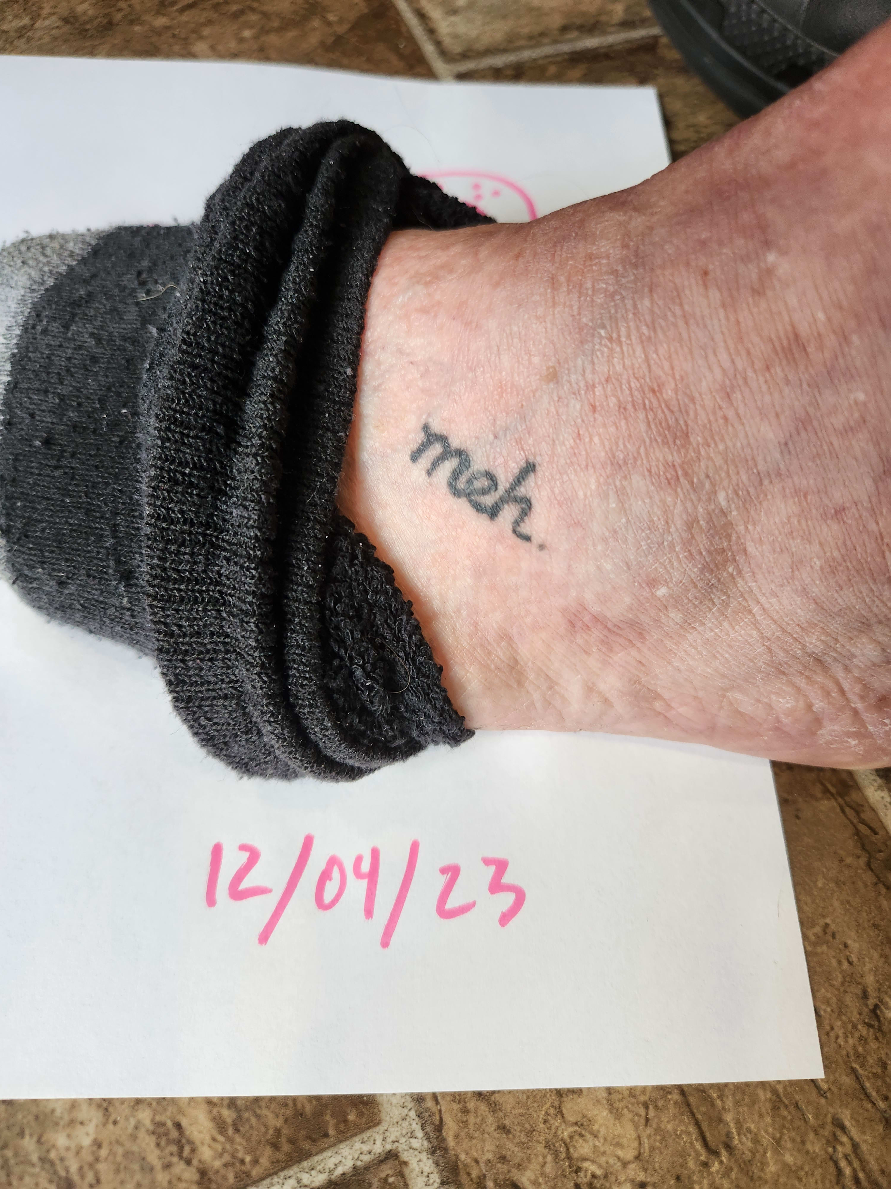 fugly-foot