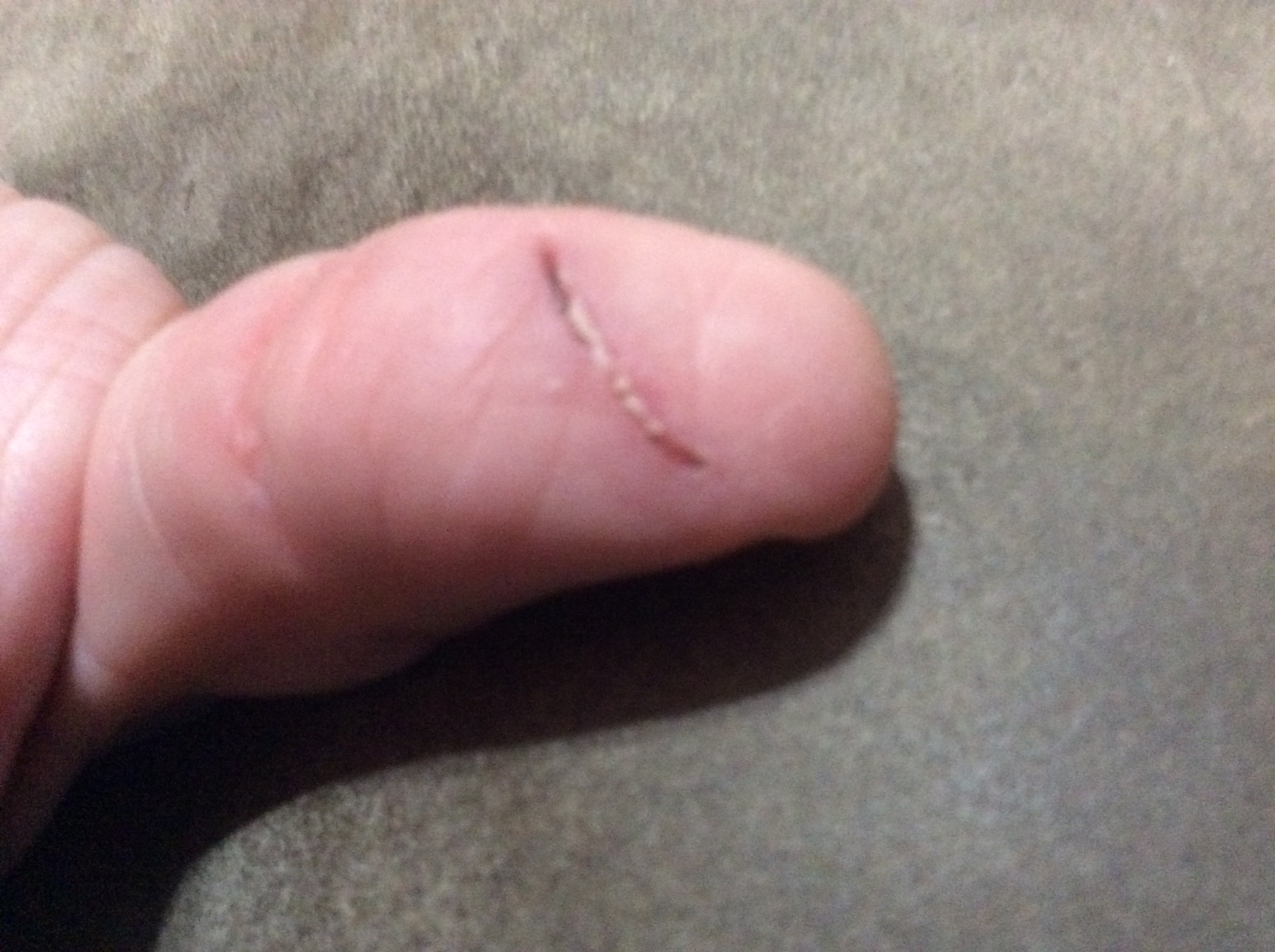 ouchie