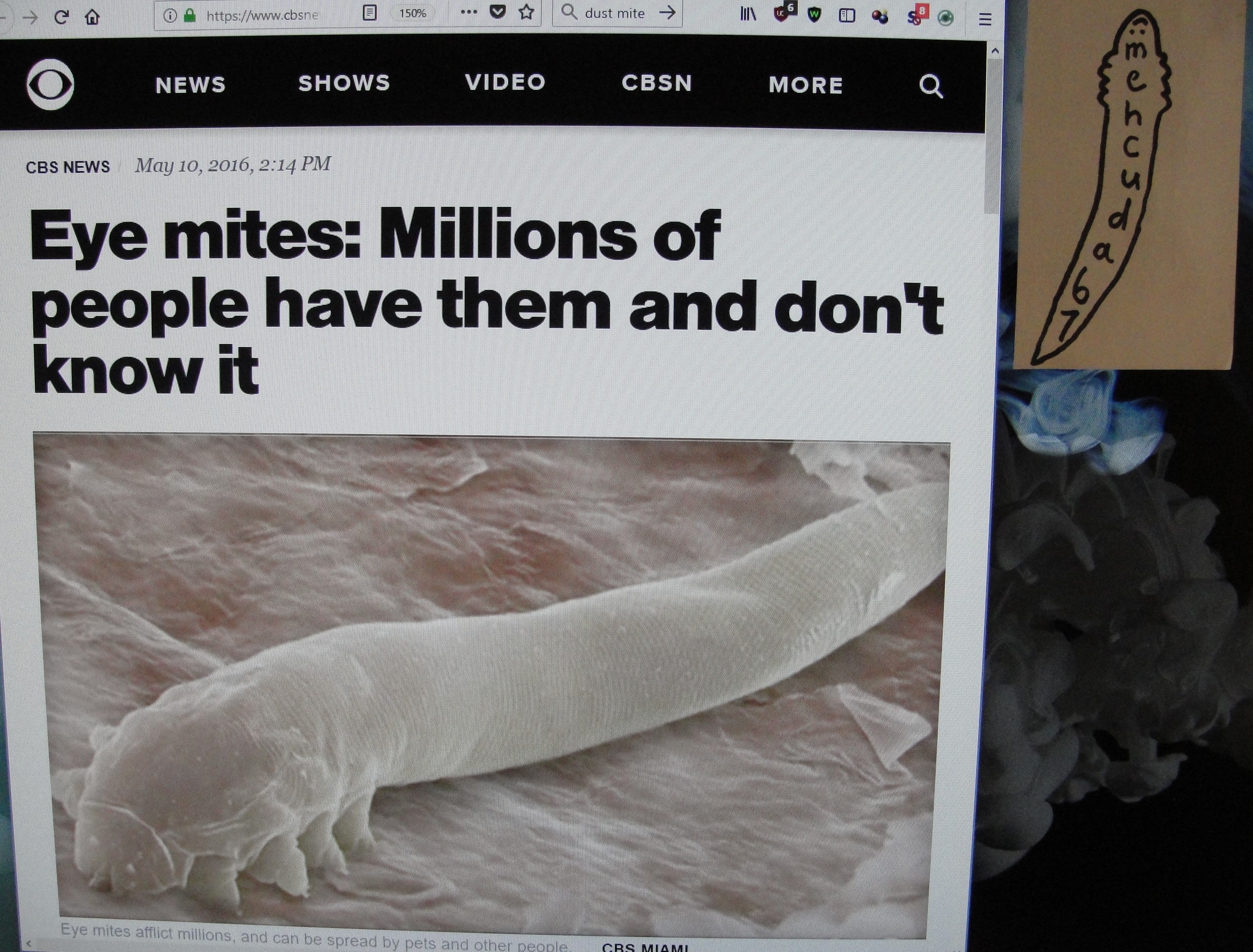 Eyelash mites